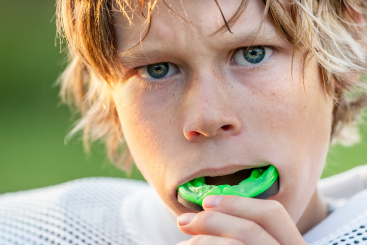 young male athlete using his mouth guard - Yukon Kids Dental